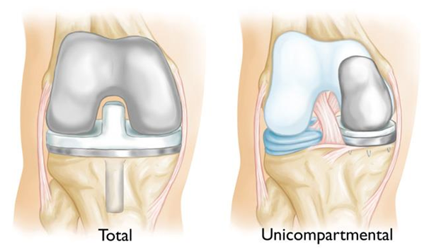 Hip and knee surgeon in cheshire