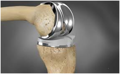  knee surgeon in cheshire